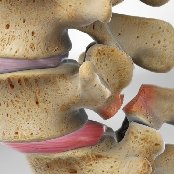 Spine Model