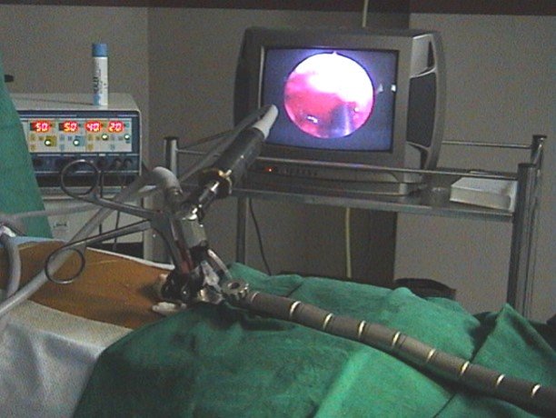 Operation Theatre View Of Minimally Invasive Surgery